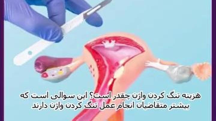 پرینوپلاستی: جراحی ترمیمی و زیبایی پرینه برای بهبود عملکرد و ظاهر ناحیه تناسلی