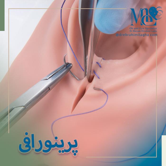 پرینورافی چیست؟ جراحی پرینه و مزایای آن برای ترمیم و زیبایی ناحیه تناسلی